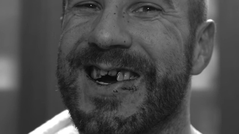 Cesaro smiling after his teeth injury