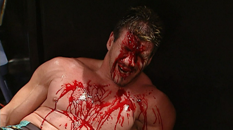 Guerrero's profuse bleeding.