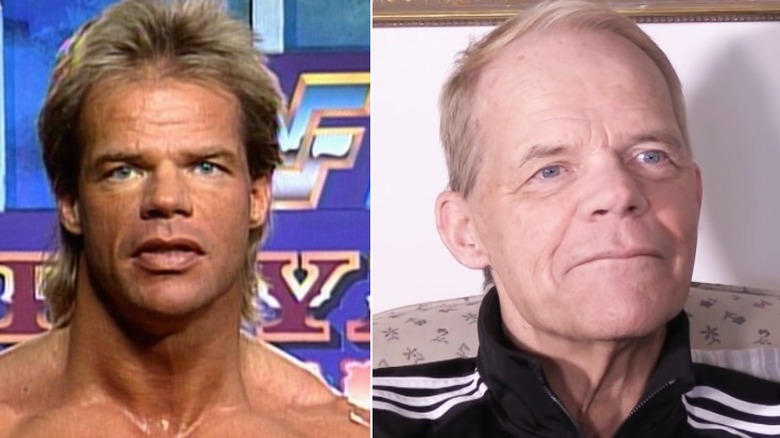 Lex Luger before and after